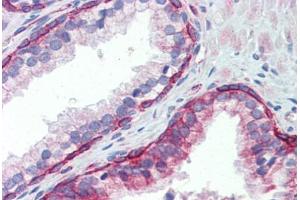 Human Prostate (formalin-fixed, paraffin-embedded) stained with UBE2L3 antibody ABIN462238 followed by biotinylated goat anti-rabbit IgG secondary antibody ABIN481713, alkaline phosphatase-streptavidin and chromogen. (UBE2L3 抗体  (C-Term))