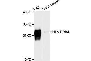 Western blot analysis of extracts of various cell lines, using HLA-DRB4 antibody (ABIN4903935) at 1:1000 dilution. (HLA-DRB4 抗体)