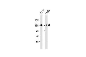 All lanes : Anti-ITGA3 Antibody (N-term) at 1:4000 dilution Lane 1: A431 whole cell lysates Lane 2: Hela whole cell lysates Lysates/proteins at 20 μg per lane. (ITGA3 抗体  (N-Term))