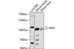 Western blot analysis of extracts of various cell lines, using GB antibody (ABIN6131314, ABIN6140988, ABIN6140989 and ABIN6216604) at 1:3000 dilution.