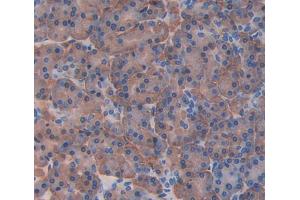 Used in DAB staining on fromalin fixed paraffin- embedded Kidney tissue (pPLA2 抗体  (AA 16-148))