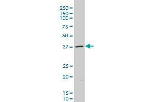 AKR1B10 polyclonal antibody (A01), Lot # UOP11060207QCS1 Western Blot analysis of AKR1B10 expression in K-562 . (AKR1B10 抗体  (AA 76-143))