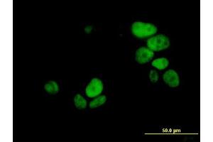 Immunofluorescence of monoclonal antibody to UHRF1 on MCF-7 cell. (UHRF1 抗体  (AA 694-793))