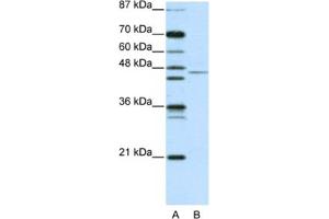 Western Blotting (WB) image for anti-Tripartite Motif Containing 14 (TRIM14) antibody (ABIN2461040) (TRIM14 抗体)