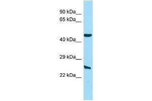 Host: Rabbit Target Name: NIPAL4 Sample Type: Hela Whole Cell lysates Antibody Dilution: 1. (NIPAL4 抗体  (N-Term))