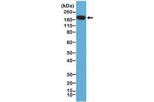 Western blot of human HeLa cell lysate using recombinant EGFR antibody at a 1:200 dilution.