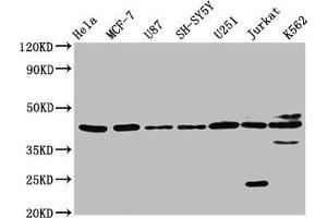 Western Blot Positive WB detected in: Hela whole cell lysate, MCF-7 whole cell lysate, U87 whole cell lysate, SH-SY5Y whole cell lysate, U251 whole cell lysate, Jurkat whole cell lysate, K562 whole cell lysate All lanes: NPY2R antibody at 3. (NPY2R 抗体  (AA 326-381))