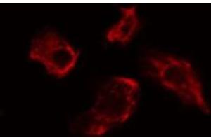 ABIN6275482 staining Hela cells by IF/ICC. (RGS7 抗体  (Internal Region))