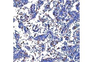 IHC analysis of PAK1 using anti-PAK1 antibody (ABIN7599852).