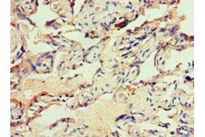 Immunohistochemistry of paraffin-embedded human placenta tissue using ABIN7156485 at dilution of 1:100 (Integrin beta 3 抗体  (AA 609-788))