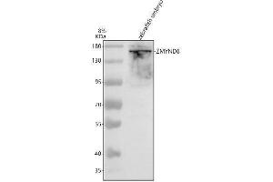 Western blot analysis of ZMYND8 using anti-ZMYND8 antibody (AZA0A0R4ISB9).