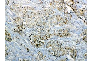 IHC analysis of GALNS using anti-GALNS antibody . (GALNS 抗体  (AA 181-289))