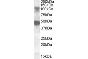 Image no. 2 for anti-serine/threonine Kinase 11 Interacting Protein (STK11IP) (AA 732-746) antibody (ABIN490511) (STK11IP 抗体  (AA 732-746))