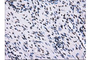 Immunohistochemical staining of paraffin-embedded colon tissue using anti-RPA2 mouse monoclonal antibody. (RPA2 抗体)