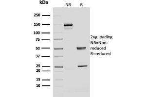 SDS-PAGE Analysis Purified BMI1 Mouse Monoclonal Antibody (BMI1/2690). (BMI1 抗体  (AA 142-326))