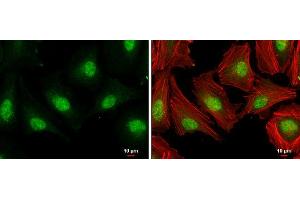 ICC/IF Image E2F1 antibody [N1N3] detects E2F1 protein at nucleus by immunofluorescent analysis.