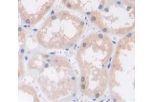 Immunohistochemistry (Paraffin-embedded Sections) (IHC (p)) image for anti-RAC1 (AA 1-189) antibody (ABIN2923291)