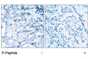 Image no. 1 for anti-Cyclin-Dependent Kinase 1 (CDK1) (pThr161) antibody (ABIN196847) (CDK1 抗体  (pThr161))