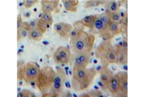 Used in DAB staining on fromalin fixed paraffin-embedded Liver tissue (EGR1 抗体  (AA 273-431))
