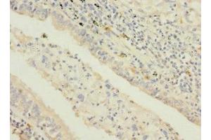 Immunohistochemistry (IHC) image for anti-Signal Transducing Adaptor Molecule (SH3 Domain and ITAM Motif) 2 (STAM2) (AA 376-525) antibody (ABIN7169694)