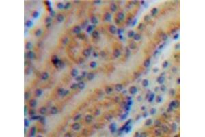 Used in DAB staining on fromalin fixed paraffin-embedded Kidney tissue (MMP7 抗体  (AA 1-267))