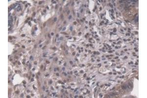 Detection of PRKDC in Mouse Uterus Tissue using Polyclonal Antibody to Protein Kinase, DNA Activated, Catalytic Polypeptide (PRKDC) (PRKDC 抗体  (AA 3899-4128))