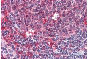 Human Tonsil (formalin-fixed, paraffin-embedded) stained with SYK antibody ABIN334248 at 10 ug/ml followed by biotinylated anti-mouse IgG secondary antibody ABIN481714, alkaline phosphatase-streptavidin and chromogen. (SYK 抗体  (AA 5-360))