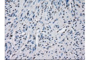 Immunohistochemical staining of paraffin-embedded endometrium tissue using anti-BUB1Bmouse monoclonal antibody. (BUB1B 抗体)