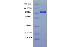 SDS-PAGE (SDS) image for FOS-Like Antigen 2 (FOSL2) (AA 1-326), (full length) protein (His-SUMO Tag) (ABIN5709533) (FOSL2 Protein (AA 1-326, full length) (His-SUMO Tag))