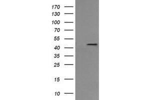 Image no. 3 for anti-Mitogen-Activated Protein Kinase Kinase 1 (MAP2K1) antibody (ABIN1499395) (MEK1 抗体)