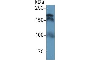 Western Blot; Sample: Human Serum; Primary Ab: 1µg/ml Rabbit Anti-Human TOP2 Antibody Second Ab: 0. (TOP2 抗体  (AA 923-1148))