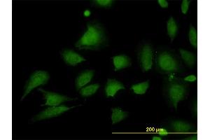 Immunofluorescence of monoclonal antibody to STIM1 on HeLa cell. (STIM1 抗体  (AA 24-685))