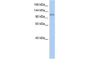 WB Suggested Anti-ZNF217 Antibody Titration:  0. (ZNF217 抗体  (N-Term))