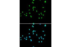 Immunofluorescence analysis of A549 cell using NR5A2 antibody. (NR5A2 + LRH1 抗体)