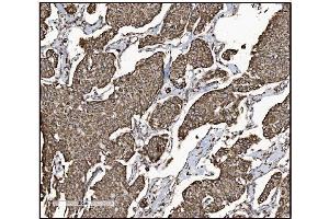 IHC analysis of FABP-1/GOT2 using anti-FABP-1/GOT2 antibody (ABIN7601426). (GOT2 抗体  (AA 35-430))