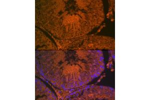 Immunofluorescence (IF) image for anti-Angiotensin I Converting Enzyme 2 (ACE2) (AA 18-250) antibody (ABIN6136429)