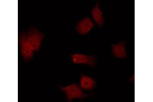 ABIN6267610 staining NIH-3T3 by IF/ICC. (FAK 抗体  (pSer843))