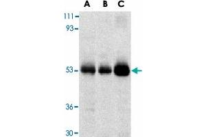 Western blot analysis of TRIM5 expression in human stomach (A), thymus (B), and uterus (C) cell lysate with TRIM5 alpha polyclonal antibody  at 2 ug /mL . (TRIM5 抗体  (C-Term))