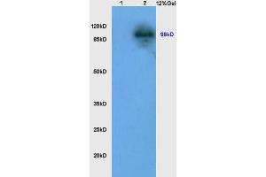 L1 mouse kidney lysates L2 mouse intestine lysates probed with Anti LONP1 Polyclonal Antibody, Unconjugated (ABIN705806) at 1:200 in 4 °C.