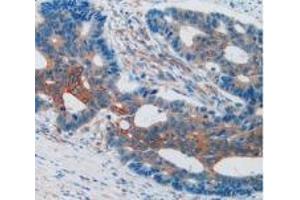 Immunohistochemistry (IHC) image for anti-Vascular Cell Adhesion Molecule 1 (VCAM1) (AA 109-318) antibody (ABIN7431959)