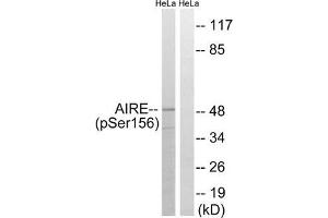 Western blot analysis of extracts from HeLa cells treated with Hu using AIRE (Phospho-Ser156) Antibody. (AIRE 抗体  (pSer156))