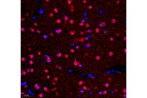 Immunofluorescence of paraffin embedded rat corpus striatum using NCBP2 (ABIN7074870) at dilution of 1: 650 (400x lens) (NCBP2 抗体)