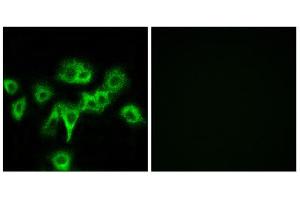 Immunofluorescence analysis of MCF-7 cells, using CDON antibody. (CDON 抗体  (Internal Region))