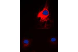 Immunofluorescent analysis of HARS staining in K562 cells. (HARS1/Jo-1 抗体  (C-Term))