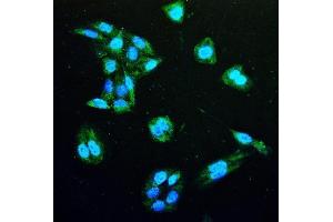 IF analysis of IDH1 using anti-IDH1 antibody (ABIN7602760). (IDH1 抗体  (C-Term))