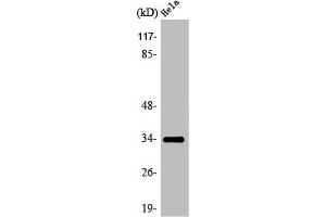 Western Blot analysis of COLO205 cells using Olfactory receptor 7C1 Polyclonal Antibody (OR7C1 抗体  (Internal Region))
