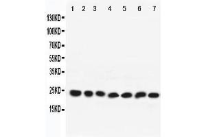 Western Blotting (WB) image for anti-RAB9A, Member RAS Oncogene Family (RAB9A) (AA 178-193), (C-Term) antibody (ABIN3042553) (RAB9A 抗体  (C-Term))