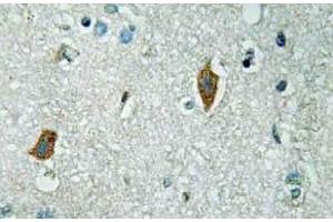 Immunohistochemistry (IHC) analyzes of PAI-2 antibody in paraffin-embedded human brain tissue. (SERPINB2 抗体)