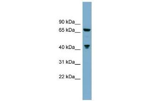 GLS antibody used at 1 ug/ml to detect target protein. (Glutaminase 抗体  (Middle Region))
