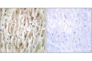 Immunohistochemistry analysis of paraffin-embedded human heart tissue, using LIMK2 Antibody. (LIMK2 抗体  (AA 461-510))